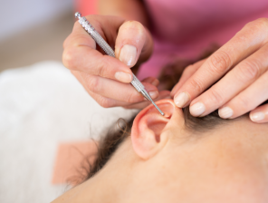 Auriculoterapia